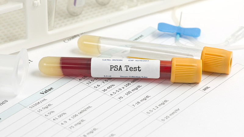 PSA Testi