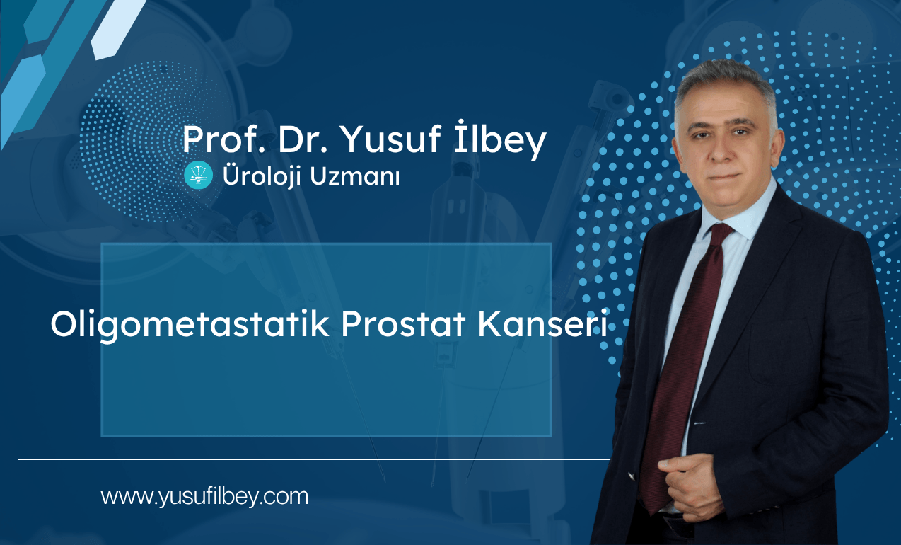 Oligometastatik Prostat Kanseri