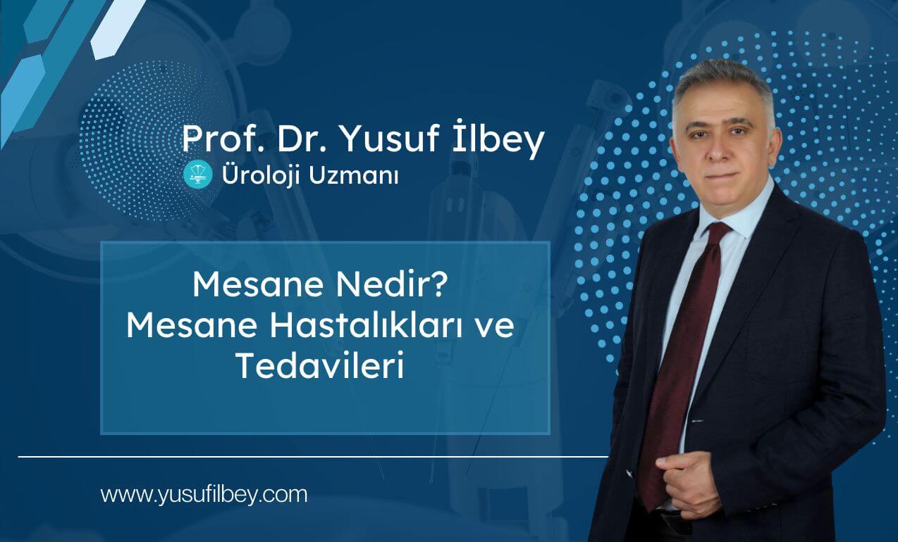 Mesane Nedir? Mesane Hastalıkları ve Tedavileri 1 Mesane Nedir? Mesane Hastalıkları ve Tedavileri Kopyala