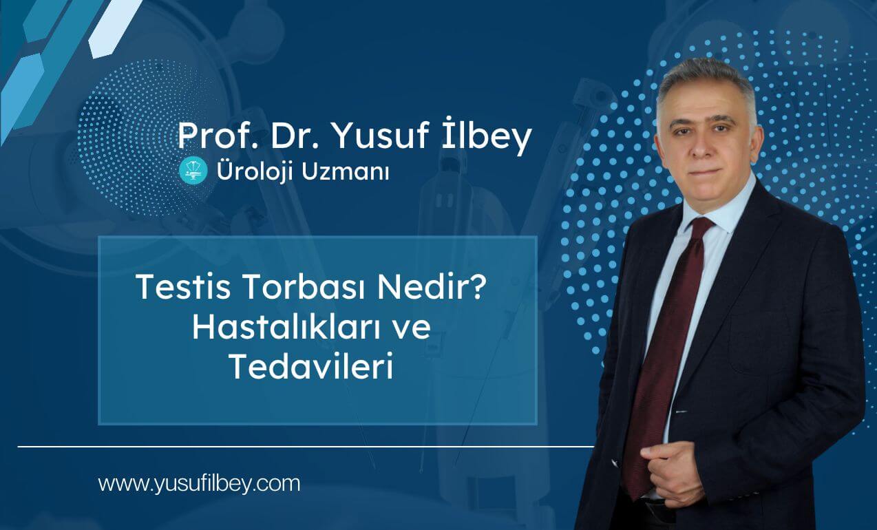 Testis Torbası Nedir? Hastalıkları ve Tedavileri 1 Testis Torbası Nedir? Hastalıkları ve Tedavileri